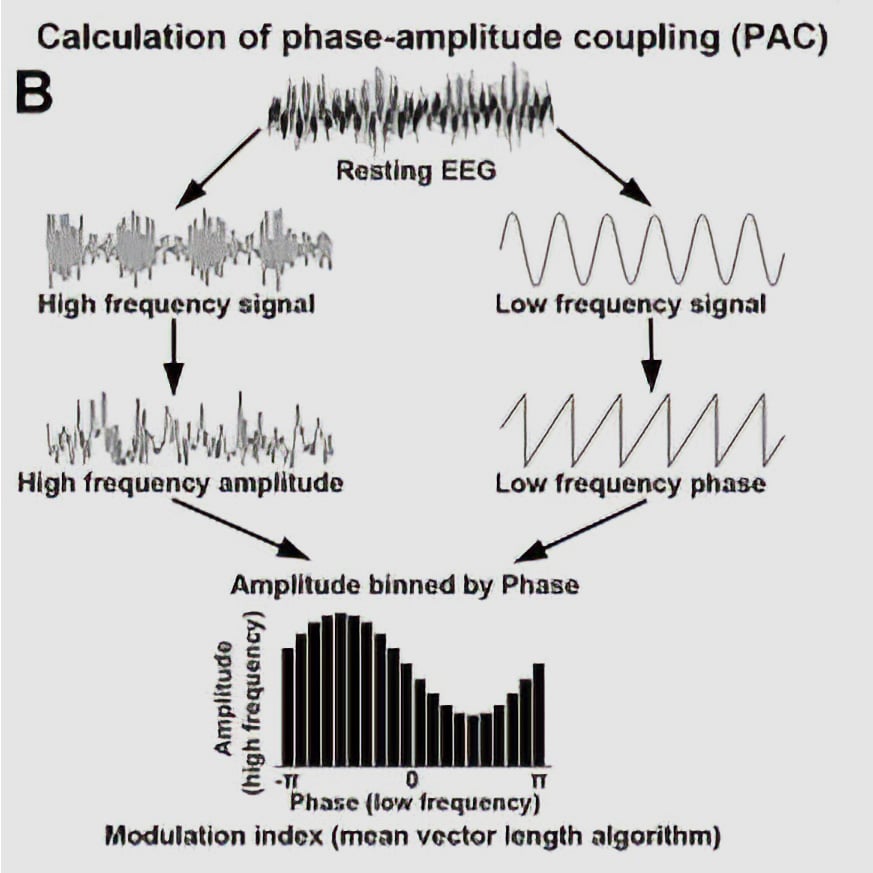 Illustration of how phase-amplitude coupling (PAC) is calculated from brain signals. Resting EEG is separated into high-frequency and low-frequency signals. The amplitude of high-frequency activity is mapped to the phase of low-frequency waves, producing a distribution used to measure neural coupling strength.