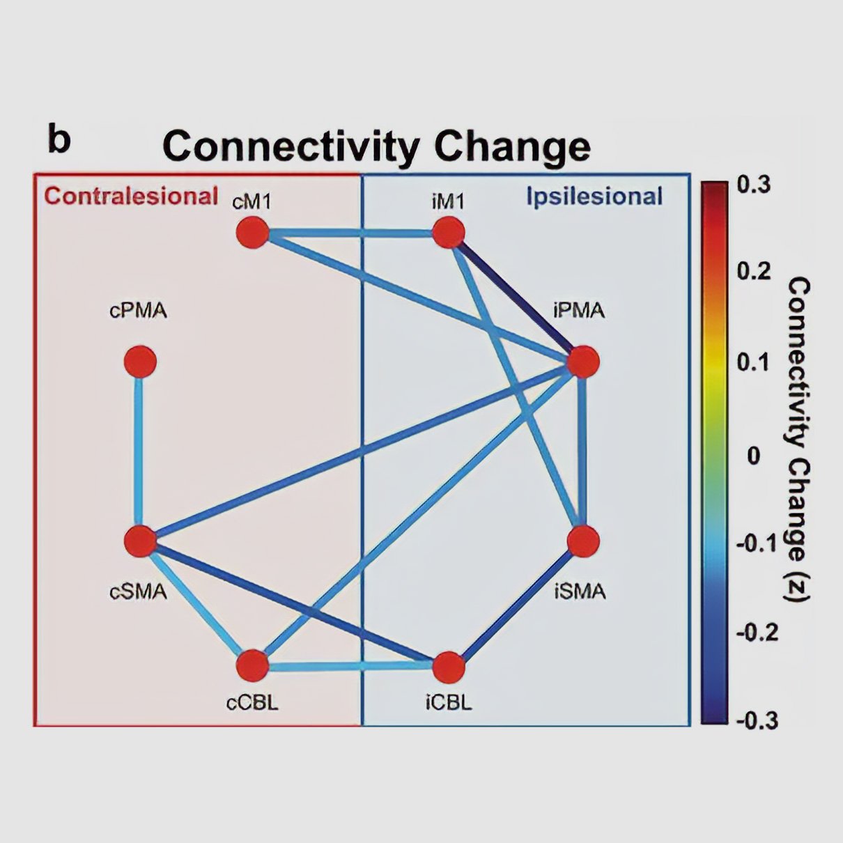 Diagram showing changes in brain connectivity after therapy. Connections between motor regions shift in strength, with color-coded lines indicating increases and decreases in connectivity, reflecting reorganization of motor networks following treatment.